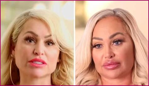 Darcey and Stacey Silva share footage as they undergo their latest cosmetic treatments